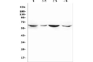 Western blot analysis of SMOX using anti-SMOX antibody (ABIN7601652).