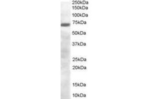 Image no. 1 for anti-PR Domain Containing 4 (PRDM4) (C-Term) antibody (ABIN374481) (PRDM4 Antikörper  (C-Term))