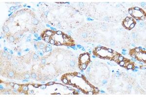 Immunohistochemistry of paraffin-embedded Mouse kidney using PIK3CA Polyclonal Antibody at dilution of 1:100 (40x lens). (PIK3CA Antikörper)