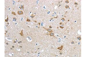 The image on the left is immunohistochemistry of paraffin-embedded Human brain tissue using ABIN7190915(HCN4 Antibody) at dilution 1/20, on the right is treated with synthetic peptide. (HCN4 Antikörper)