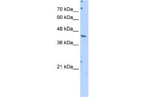 WB Suggested Anti-GOT1 Antibody Titration:  1. (GOT1 Antikörper  (N-Term))