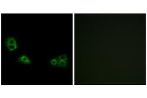 Immunofluorescence analysis of MCF-7 cells, using TMEM185A antibody. (TMEM185A Antikörper  (C-Term))