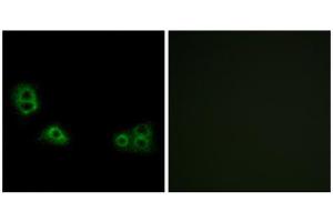 Immunofluorescence analysis of MCF-7 cells, using TMEM185A antibody.