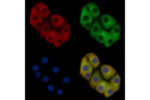 MYH9 Mouse Monoclonal Antibody staining Hela cells by IF/ICC. (Myosin 9 Antikörper  (C-Term))