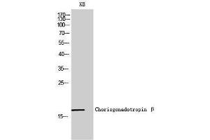 Western Blotting (WB) image for anti-Chorionic Gonadotropin, beta Polypeptide (CGB) (C-Term) antibody (ABIN3183911) (CGB Antikörper  (C-Term))