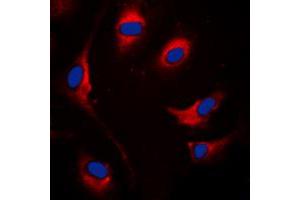 Immunofluorescent analysis of SOCS1 staining in MCF7 cells. (SOCS1 Antikörper  (Center))