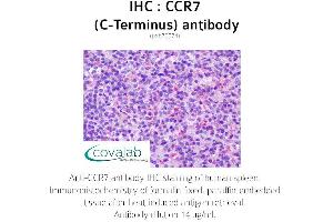 Image no. 1 for anti-Chemokine (C-C Motif) Receptor 7 (CCR7) (C-Term) antibody (ABIN1732781)