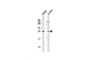 Western Blot at 1:2000 dilution Lane 1: K562 whole cell lysates Lane 2: Jurkat whole cell lysates Lysates/proteins at 20 ug per lane. (BASP1 Antikörper  (AA 123-150))