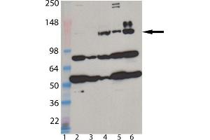 Western blot analysis of MDA5 monoclonal antibody (1B6) : Lane 1: MW marker, Lane 2: HeLa, Lane 3: A431, Lane 4: L929, Lane 5: 3T3, Lane 6: Jurkat cell lysate. (IFIH1 Antikörper  (AA 78-555))