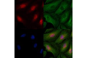 ABIN6257122 and ABIN6273438 staining  cells by IF/ICC. (Cyclin T2 Antikörper  (Internal Region))