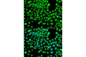 Immunofluorescence analysis of A549 cells using GOPC antibody (ABIN5975587). (GOPC Antikörper)