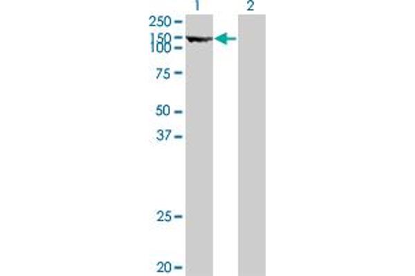 Thyroperoxidase Antikörper  (AA 672-779)