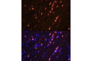 Immunofluorescence analysis of mouse brain using S100B Rabbit mAb (ABIN7270131) at dilution of 1:100 (40x lens).