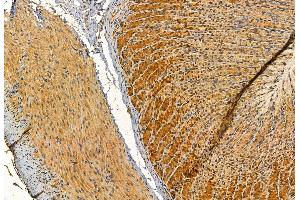 ABIN6262481 and ABIN6272891 at 1/100 staining Rat stomach tissue by IHC-P. (IFT57 Antikörper  (Internal Region))