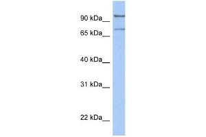 LCMT2 antibody used at 1 ug/ml to detect target protein. (LCMT2 Antikörper  (C-Term))