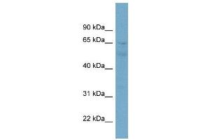WB Suggested Anti-ZNF671  Antibody Titration: 0. (ZNF671 Antikörper  (N-Term))