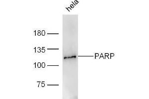 Human HeLa lysates probed with Rabbit Anti-PARP1 Polyclonal Antibody, Unconjugated  at 1:5000 for 90 min at 37˚C. (PARP1 Antikörper  (AA 201-300))