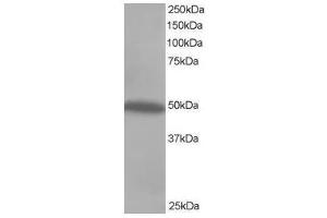 Image no. 1 for anti-C-Src tyrosine Kinase (CSK) (C-Term) antibody (ABIN374096) (CSK Antikörper  (C-Term))