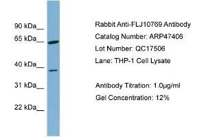 WB Suggested Anti-FLJ10769  Antibody Titration: 0. (FLJ10769 (Middle Region) Antikörper)