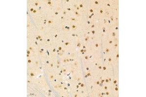 Immunohistochemistry (Paraffin-embedded Sections) (IHC (p)) image for anti-PHD Finger Protein 10 (PHF10) antibody (ABIN7075029)