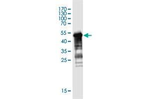 Western Blot detection against Immunogen (48. (MGC50273 (AA 1-209) Antikörper)