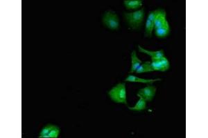 Immunofluorescent analysis of MCF-7 cells using ABIN7150470 at dilution of 1:100 and Alexa Fluor 488-congugated AffiniPure Goat Anti-Rabbit IgG(H+L) (CRCP Antikörper  (AA 1-115))