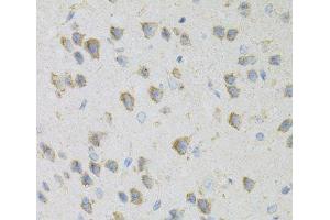 Immunohistochemistry (Paraffin-embedded Sections) (IHC (p)) image for anti-Cytidine Deaminase (CDA) antibody (ABIN7257523)