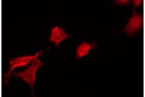 ABIN6269100 staining 293 by IF/ICC. (FYN Antikörper  (C-Term))