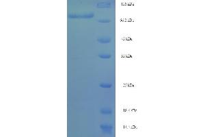 SDS-PAGE (SDS) image for DDB1 and CUL4 Associated Factor 4 (DCAF4) (AA 1-495), (full length) protein (His-SUMO Tag) (ABIN5711699)
