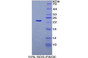 SDS-PAGE analysis of Rat SIT1 Protein. (SIT1 Protein)