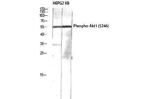 Western Blotting (WB) image for anti-V-Akt Murine Thymoma Viral Oncogene Homolog 1 (AKT1) (pSer246) antibody (ABIN3179383) (AKT1 Antikörper  (pSer246))