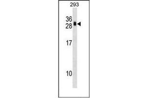 Western blot analysis of Calcipressin-1 Antibody  in 293 cell line lysates (35ug/lane). (RCAN1 Antikörper  (N-Term))