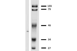 Western blotting analysis of HLA-G in LCL-HLA-G transfectants using anti-HLA-G (MEM-G/2).