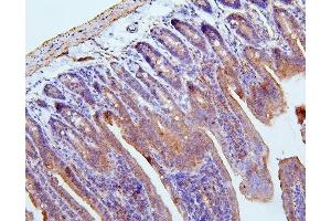 IHC analysis of Filamin B/FLNB using anti-Filamin B/FLNB antibody (ABIN7601607).