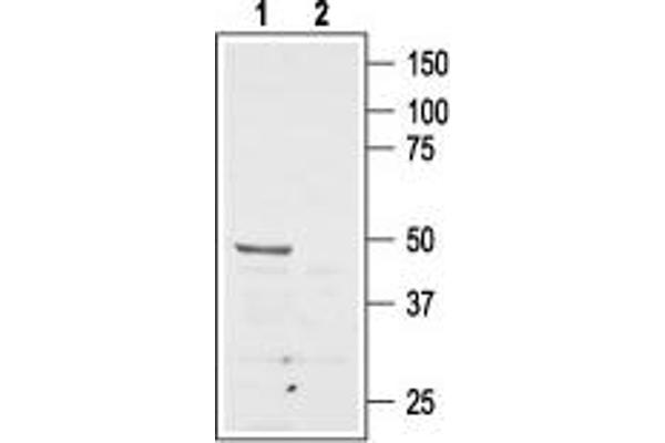 Angiotensin II Type 2 Receptor Antikörper  (Extracellular, N-Term)