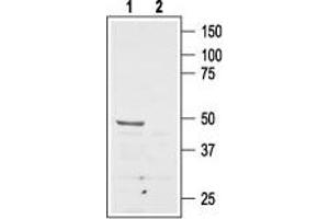 Angiotensin II Type 2 Receptor Antikörper  (Extracellular, N-Term)