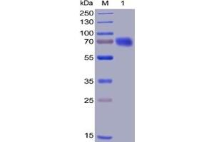 Human CD28 Protein, mFc-His Tag on SDS-PAGE under reducing condition. (CD28 Protein (CD28) (mFc-His Tag))