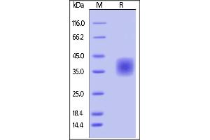 SDS-PAGE (SDS) image for CD47 (CD47) (AA 19-139) (Active) protein (His tag,AVI tag,Biotin) (ABIN4949015)