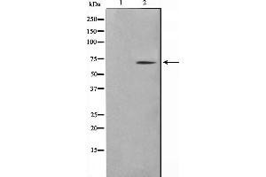Western blot analysis on NIH-3T3 cell lysate using TGFR2 Antibody,The lane on the left is treated with the antigen-specific peptide. (TGFBR2 Antikörper  (Internal Region))