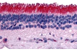 Human Retina (formalin-fixed, paraffin-embedded) stained with PTPRM antibody ABIN292586 at 15 ug/ml followed by biotinylated goat anti-rabbit IgG secondary antibody ABIN481713, alkaline phosphatase-streptavidin and chromogen. (PTPRM Antikörper  (Internal Region))