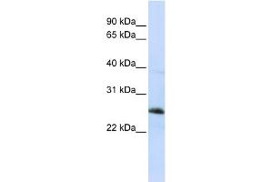 WB Suggested Anti-RTN1 Antibody Titration:  0. (Reticulon 1 Antikörper  (Middle Region))
