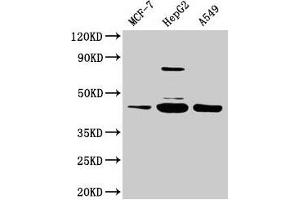 Western Blot Positive WB detected in: MCF-7 whole cell lysate, HepG2 whole cell lysate, A549 whole cell lysate All lanes: SERPINB1 antibody at 2 μg/mL Secondary Goat polyclonal to rabbit IgG at 1/50000 dilution Predicted band size: 43, 27 kDa Observed band size: 43 kDa