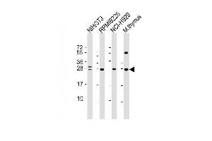 Lane 1: NIH/3T3 Cell lysates, Lane 2: RPMI8226 Cell lysates, Lane 3: NCI-H929 Cell lysates, Lane 4: mouse thymus lysates, probed with FGFR1OP2 (1675CT713. (FGFR1OP2 Antikörper)
