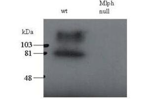 Image no. 2 for anti-Melanophilin (MLPH) (C-Term) antibody (ABIN374219)