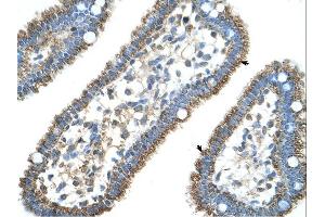 CPS1 antibody was used for immunohistochemistry at a concentration of 4-8 ug/ml.