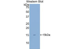Western blot analysis of the recombinant protein. (SIGIRR Antikörper  (AA 1-118))