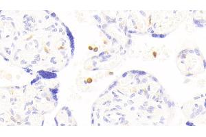 Immunohistochemistry (IHC) image for anti-Amyloid beta (A4) Precursor Protein-Binding, Family B, Member 1 Interacting Protein (APBB1IP) (AA 188-421) antibody (ABIN7443662)