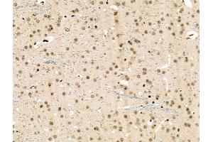 Phospho-NMDAR2A (Ser1155) Antibody at 1/100 staining Mouse brain tissue by IHC-P. (NMDAR2A Antikörper  (pSer1155))