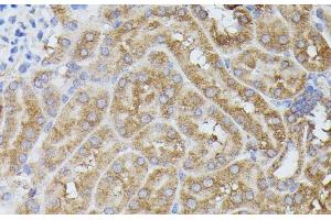 Immunohistochemistry (Paraffin-embedded Sections) (IHC (p)) image for anti-Protein Phosphatase 2, Regulatory Subunit B', delta (PPP2R5D) antibody (ABIN7258604)