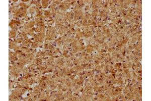 IHC image of ABIN7171626 diluted at 1:400 and staining in paraffin-embedded human adrenal gland tissue performed on a Leica BondTM system. (TBC1D25 Antikörper  (AA 1-219))